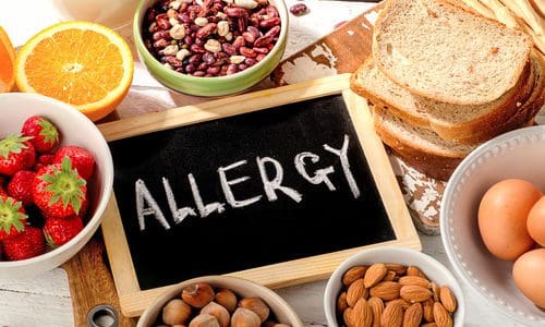 Food businesses urged to embrace Natasha’s law